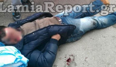 Αιματηρή ληστεία στη Λαμία: Πυροβόλησαν άνδρα 3 φορές εξ' επαφής - Φωτογραφία 2