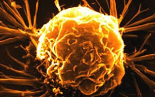 «Όπλο» κατά του καρκίνου η ογκο-υπερθερμία - Φωτογραφία 1