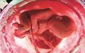 Τα έμβρυα αντιλαμβάνονται συλλαβές πριν τη γέννησή τους
