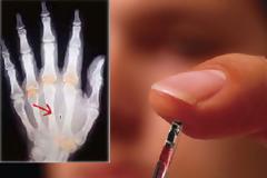 CHIP RFID (ΤΣΙΠ). ΕΧΕΤΕ ΑΝΑΡΩΤΗΘΕΙ ΠΟΤΕ, ΠΩΣ ΛΕΙΤΟΥΡΓΕΙ ?
