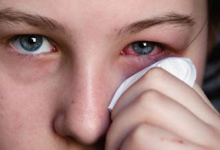 Αλλεργίες: Αντιμετωπίστε τις αποτελεσματικά! - Φωτογραφία 1