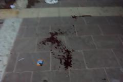 Βάφτηκε με αίμα η Κεντρική Πλατεία της Ξάνθης! [video]