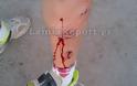 Λαμία: Άγρια επίθεση σκύλου σε ποδηλάτη - ΦΩΤΟ