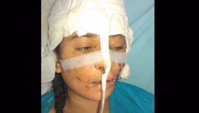 Tης άνοιξε το κεφάλι με τσεκούρι για την... τιμή του! - Φωτογραφία 2