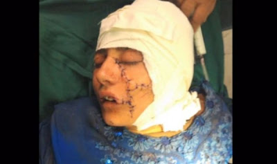 Tης άνοιξε το κεφάλι με τσεκούρι για την... τιμή του! - Φωτογραφία 3