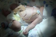 Κοριτσάκι γεννήθηκε χωρίς… αίμα!