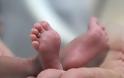 Συσκευή από σιλικόνη μειώνει τις πρόωρες γεννήσεις
