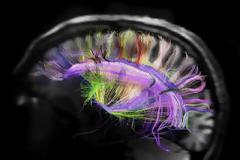 Αποκρυπτογραφώντας τους δρόμους του μυαλού