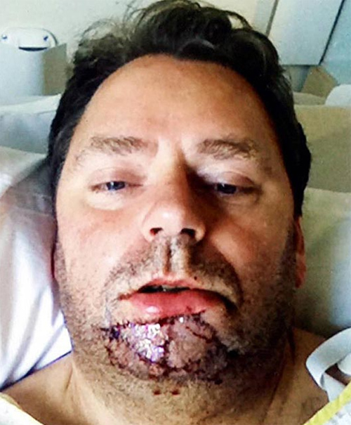 ΔΕΙΤΕ: Η σύντροφός του τού δάγκωσε και του έκοψε το σαγόνι! - Φωτογραφία 2