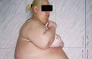 Έκοψαν την κοιλιά της που ζύγιζε 57 κιλά - Φωτογραφία 1