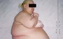 Έκοψαν την κοιλιά της που ζύγιζε 57 κιλά - Φωτογραφία 2
