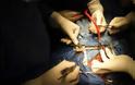 Καινοτόμος επέμβαση μεταμόσχευσης οστών στο «Ερρίκος Ντυνάν»
