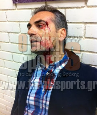Φωτογραφίες-σoκ του τραυματισμένου γενικού αρχηγού του Πανθρακικού - Φωτογραφία 3