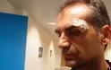 Φωτογραφίες-σoκ του τραυματισμένου γενικού αρχηγού του Πανθρακικού