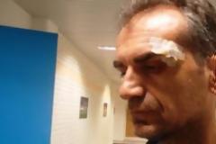 Φωτογραφίες-σoκ του τραυματισμένου γενικού αρχηγού του Πανθρακικού