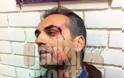 Φωτογραφίες-σoκ του τραυματισμένου γενικού αρχηγού του Πανθρακικού - Φωτογραφία 3