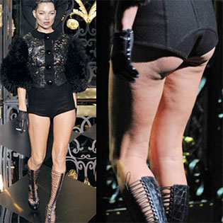 Σοκάρει η φωτογραφία του μοντέλου στην πασαρέλα - Kακή διατροφή και έλλειψη άσκησης, η αιτία του κακού! - Φωτογραφία 4