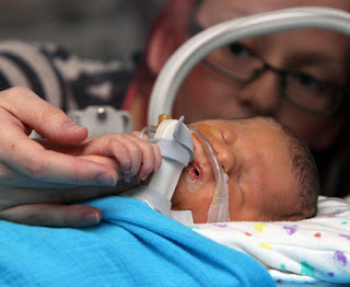 Το μωρό που έχει κάνει τους γιατρούς να θέλουν να σκίσουν τα διπλώματά τους! - Φωτογραφία 2