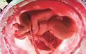 Υγεία: Η λευχαιμία των παιδιών αρχίζει στην εμβρυϊκή ζωή