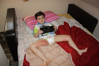 Διαβάστε την περιπέτεια του 4χρονου Μανώλη που βρέθηκε στην ανάγκη του Εθνικού Συστήματος Υγείας της χώρας μας - Το μωρό το τσίμπησαν τσούχτρες και στο νοσοκομείο δεν υπήρχαν ούτε αλοιφές και γάζες - Φωτογραφία 1