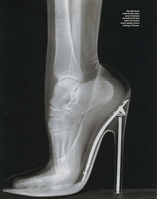 Σοκαριστική φωτο: Δείτε μια ακτινογραφία σε γυναικείo πόδι με γόβα... - Φωτογραφία 2