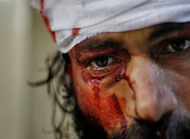Φωτογραφικό υλικό από τον εμφύλιο στη Συρία - ΠΡΟΣΟΧΗ σκληρές εικόνες - - Φωτογραφία 26