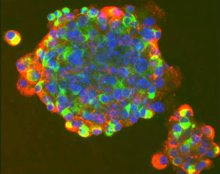 Επιστήμονες δημιούργησαν ανθρώπινα βλαστοκύτταρα μέσω κλωνοποίησης - Φωτογραφία 1