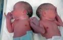 Η πιο συγκινητική φωτογραφία: Δυο αδερφάκια γεννήθηκαν χέρι-χέρι!