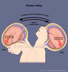 Γονείς και νταντάδες τέρατα κάνουν το «baby shaking» την πιο θανατηφόρα μάστιγα στις ΗΠΑ - Φωτογραφία 4