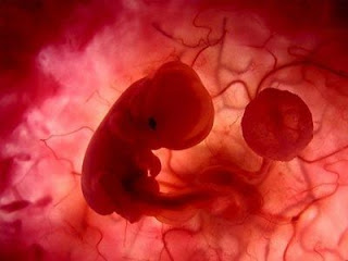 Απαγόρευτηκε άμβλωση σε άρρωστη γυναίκα - Φωτογραφία 1