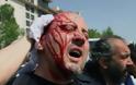 Xάος στην Τουρκία: 4 νεκροί και εκατοντάδες τραυματίες σε αντικυβερνητικές διαδηλώσεις - Φωτογραφία 2