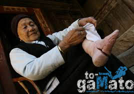 Σοκαριστικές εικόνες: Δείτε πως κάνουν τα πόδια τους οι Κινέζες για να δείξουν πως ανήκουν σε υψηλή κοινωνική τάξη - Φωτογραφία 2