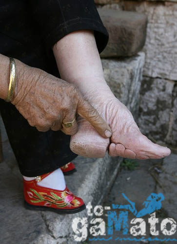 Σοκαριστικές εικόνες: Δείτε πως κάνουν τα πόδια τους οι Κινέζες για να δείξουν πως ανήκουν σε υψηλή κοινωνική τάξη - Φωτογραφία 3