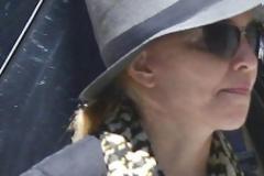 Τι έπαθε το πρόσωπο της Madonna;