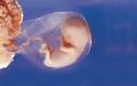 Τα έμβρυα αυνανίζονται - Σάλο προκαλεί η δήλωση γνωστού πολιτικού