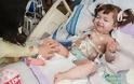 Πέθανε η δίχρονη που είχε υποβληθεί σε μεταμόσχευση τραχείας από βλαστοκύτταρα