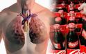 ΣΟΚ: Εθισμένος στην coca cola, πέθανε με πρησμένα πνευμόνια 4 φορές περισσότερο από το κανονικό!