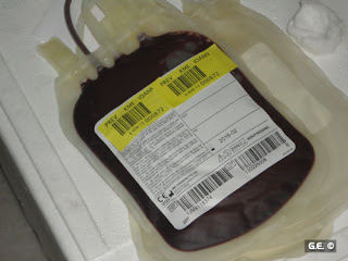 Ανάγκη για αίμα και αιμοπετάλια έχει ο μικρός Κωνσταντίνος από τον Μύτικα Πρέβεζας - Φωτογραφία 1