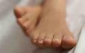 Υγεία: Πώς θα αποφύγουμε τη μυκητίαση των ποδιών