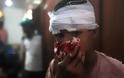 Πενήντα φωτογραφίες από τη κόλαση στην Αίγυπτο - Φωτογραφία 35
