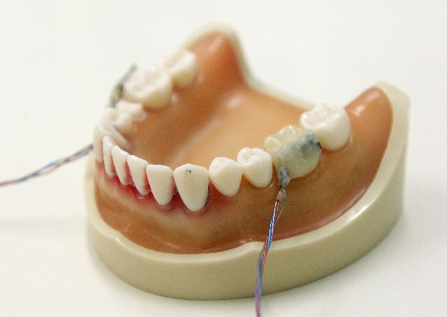 Το «Έξυπνο Δόντι»... παρακολουθεί - Φωτογραφία 2