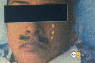 Γιατροί εξευτέλισαν ασθενή ζωγραφίζοντάς της το πρόσωπο - Φωτογραφία 1