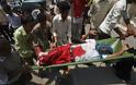 Τουλάχιστον 44 άνθρωποι σκοτώθηκαν σήμερα στην Υεμένη
