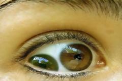 10 άνθρωποι με εξωπραγματικές ικανότητες!