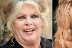 ΔΕΙΤΕ: Οι celebrities που… κακογέρασαν!