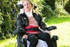 Ζει «εγκλωβισμένη» στο ίδιο της το σώμα