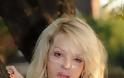 Kate Piper : Η παρουσιάστρια που δέχθηκε επίθεση με οξύ στο πρόσωπο - Φωτογραφία 3