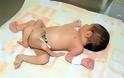 ΑΠΙΣΤΕΥΤΟ: Μωρό με έξι πόδια γεννήθηκε στο Πακιστάν!