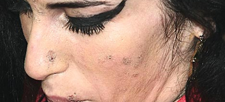 Απομυθοποίηση μιας νεκρής σταρ στην Daily Mail: Το άρρωστο δέρμα της Είμι Γουαϊνχάουζ προκαλεί σοκ - Φωτογραφία 1