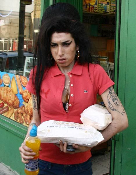 ΣΟΚΑΡΙΣΤΙΚΕΣ ΕΙΚΟΝΕΣ: H Amy Winehouse υπέφερε από βακτηριακή μόλυνση - Φωτογραφία 2